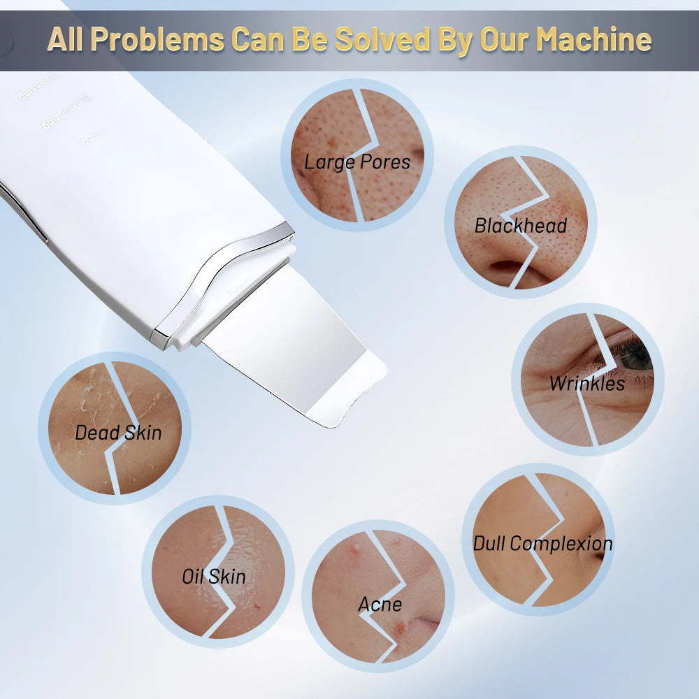 Ultrasonic Skin Scrubber